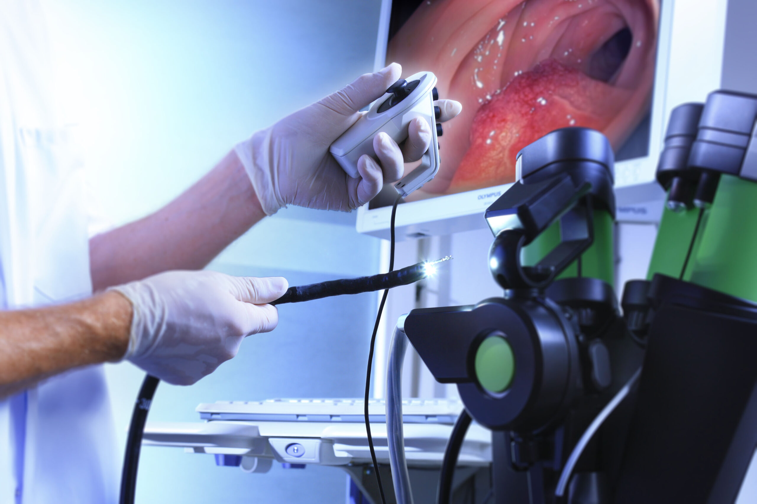 Gastroscopy and colonoscopy: key procedures to early detect gastric cancer